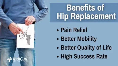 Benefits of Hip Replacement